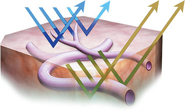 narrow-band-imaging.jpg